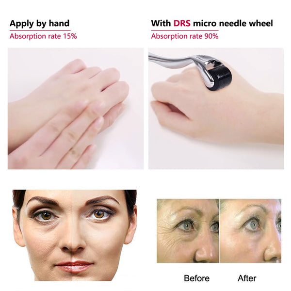 Micro-Needle Derma Roller