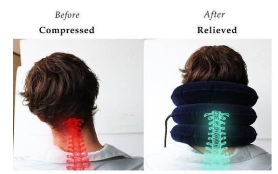 Air Therapy Neck Support
